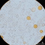 Micrococcus Lysate